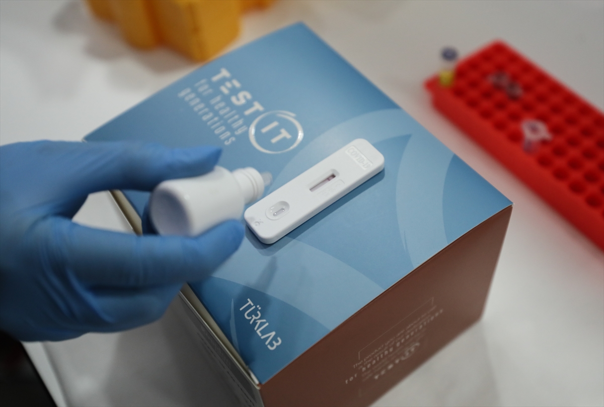 izmir-de-uretilen-antikor-testi-50-ulkeye-dagitildi (15)