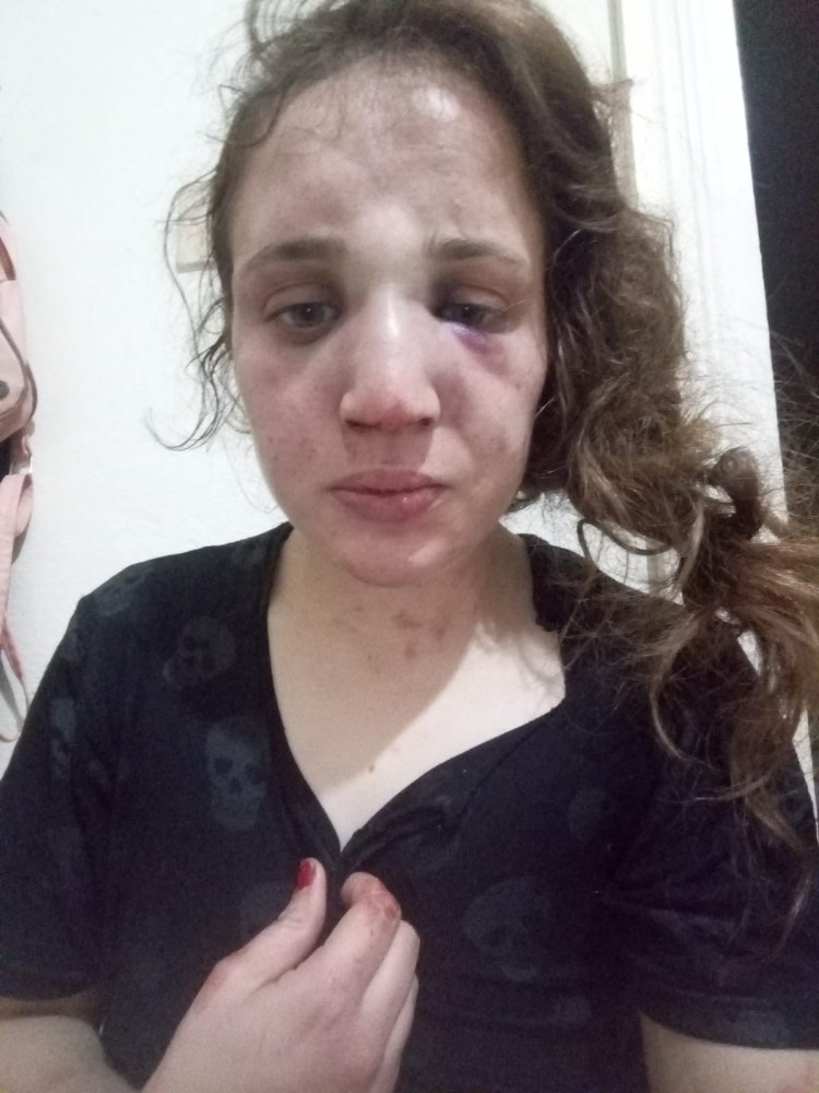 dayakci kocaya 60 gunluk uzaklastirma verildi 2 9Q9TpqhM Dayakçı kocaya 60 günlük uzaklaştırma verildi